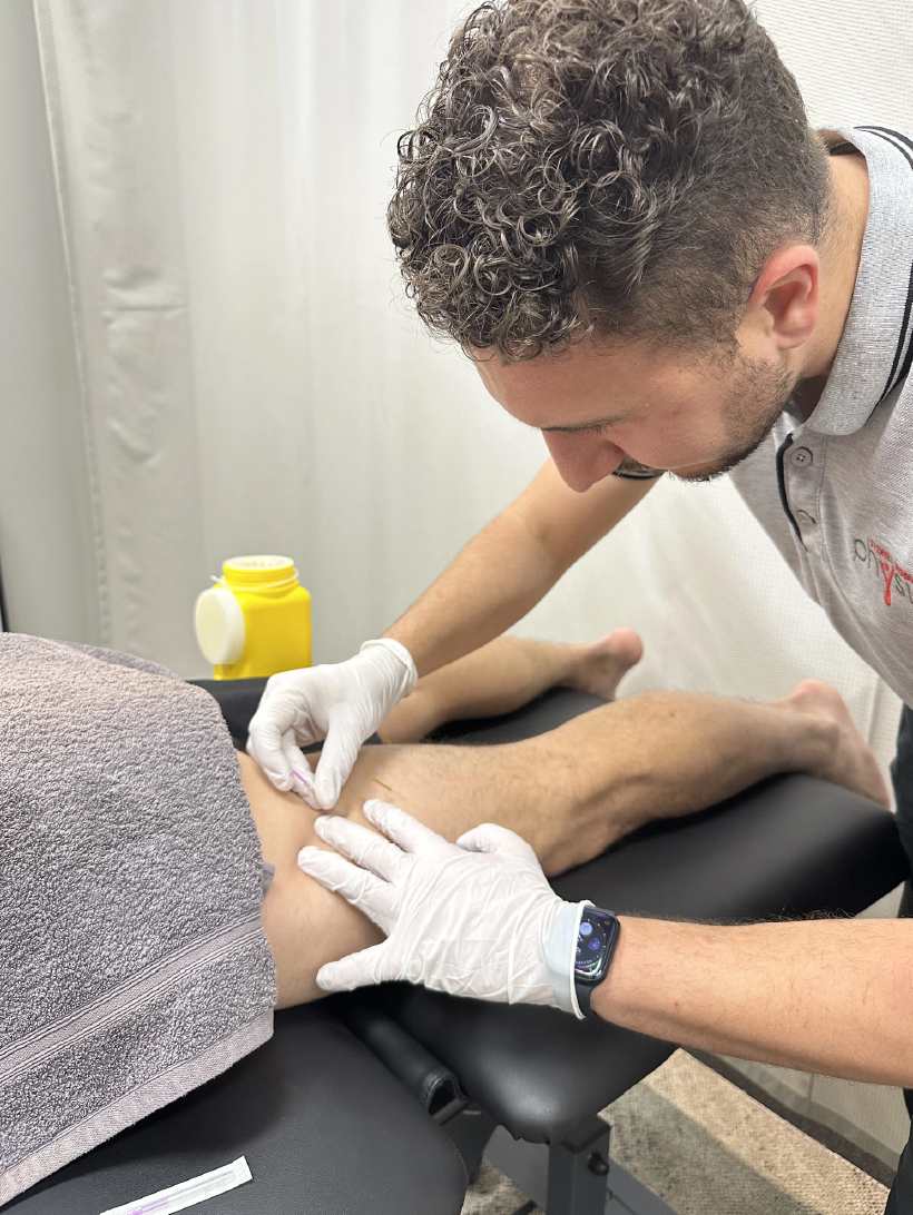 Matt using needling technique